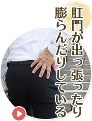 肛門が出っ張ったり膨らんだりしている