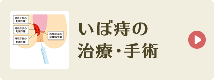 いぼ痔の治療・手術