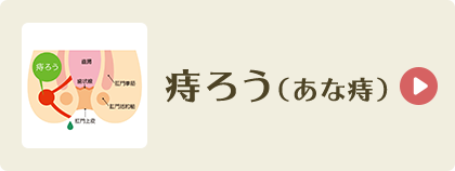 痔ろう（あな痔）